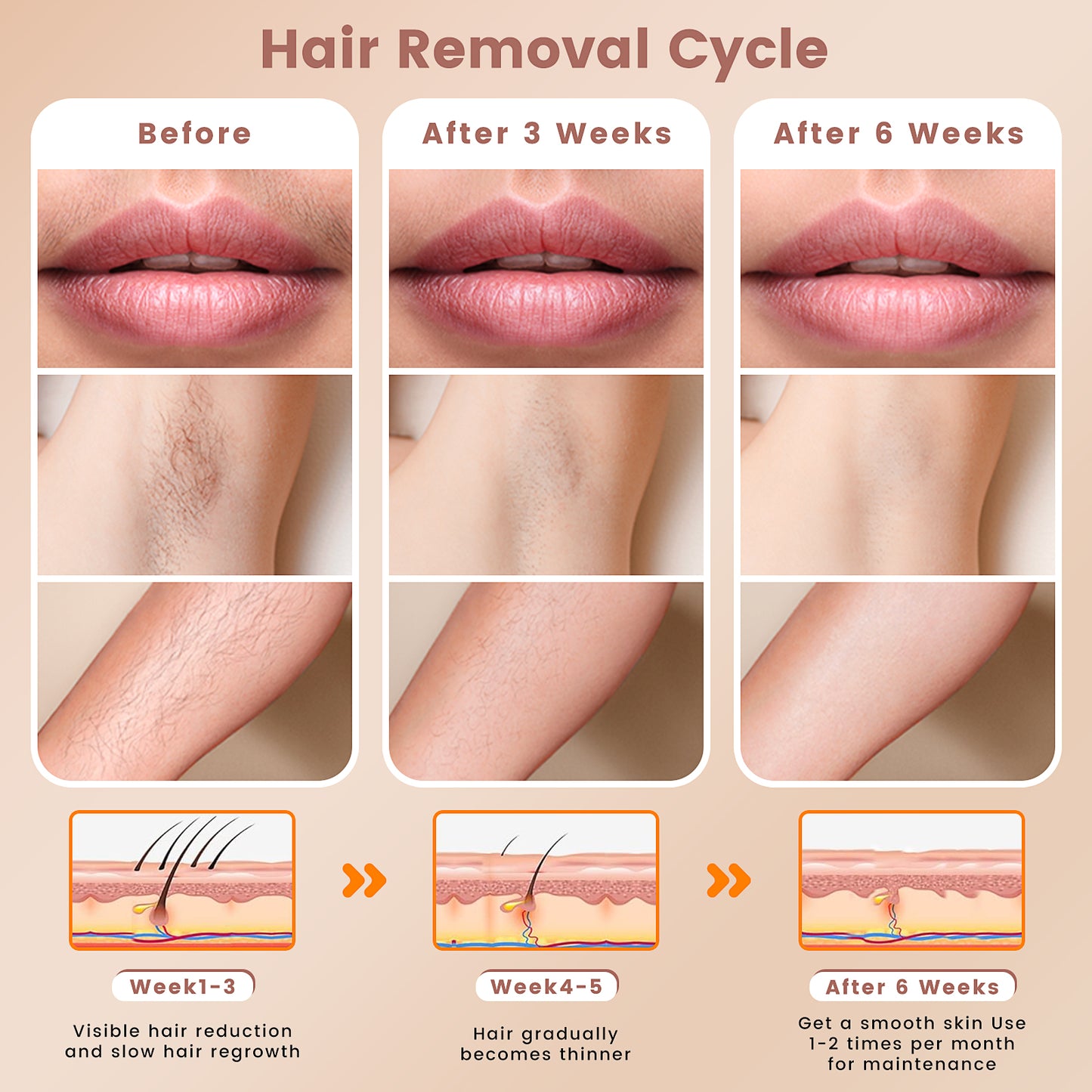 Laser Hair Removal, SweetLF IPL Hair Removal Device for Women and Men Face Permanent, 999999 Flashes for Arm Leg Whole Body Use